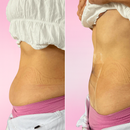 Fitas Liftee – Sua pele firme em segundos