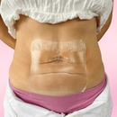 Fitas Liftee – Sua pele firme em segundos